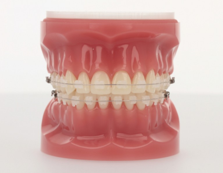 Virtual Product Library American Orthodontics