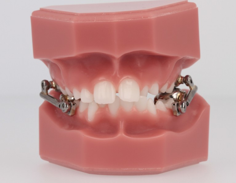 Virtual Product Library American Orthodontics