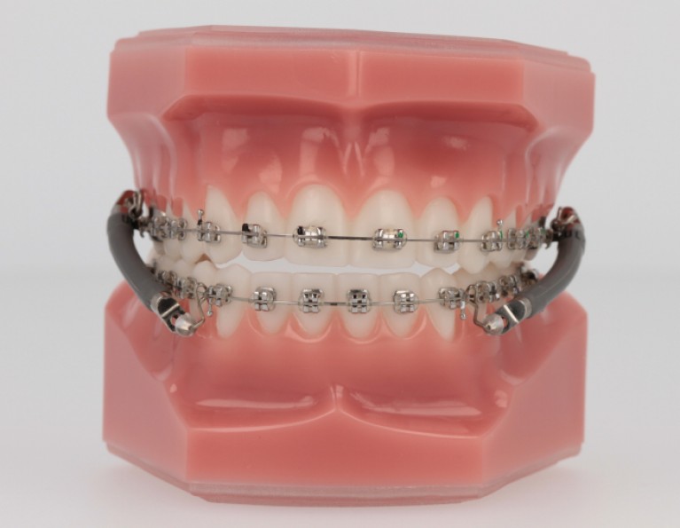 Virtual Product Library American Orthodontics