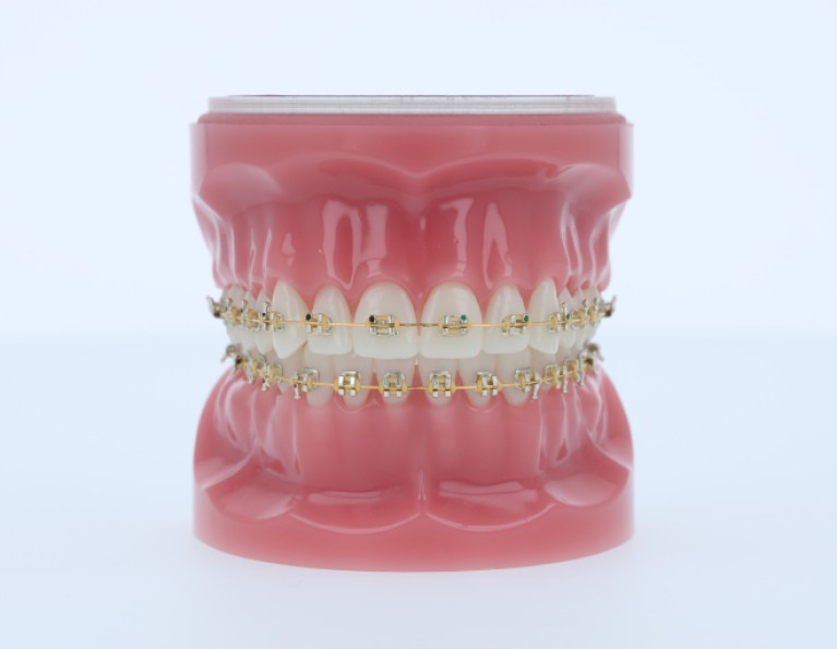 Virtual Product Library American Orthodontics