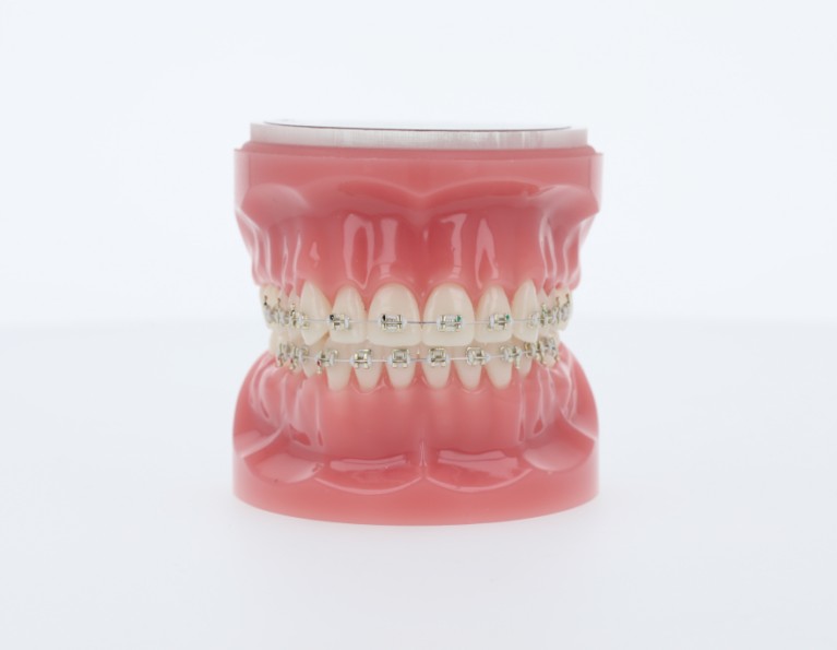 Virtual Product Library American Orthodontics