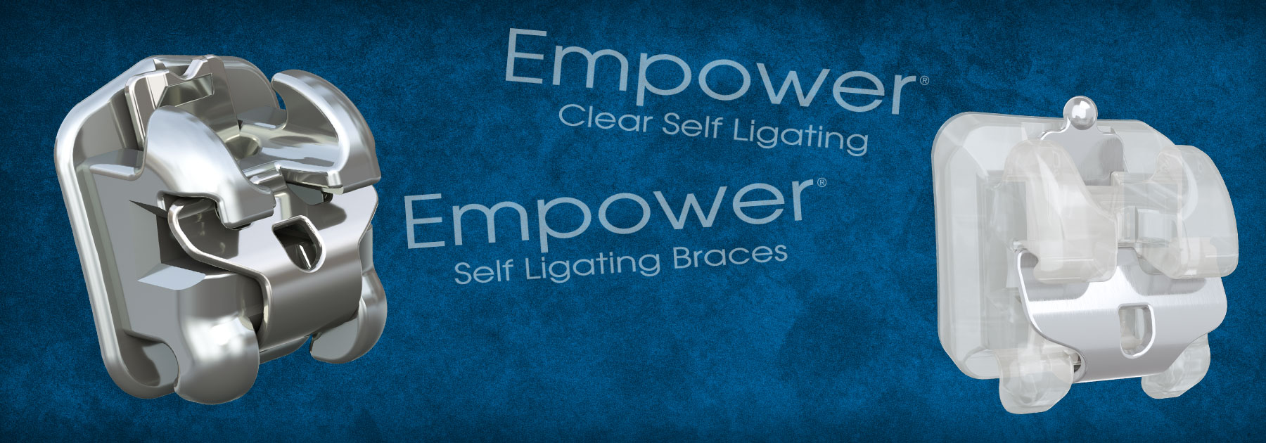 Self Ligating Brackets American Orthodontics