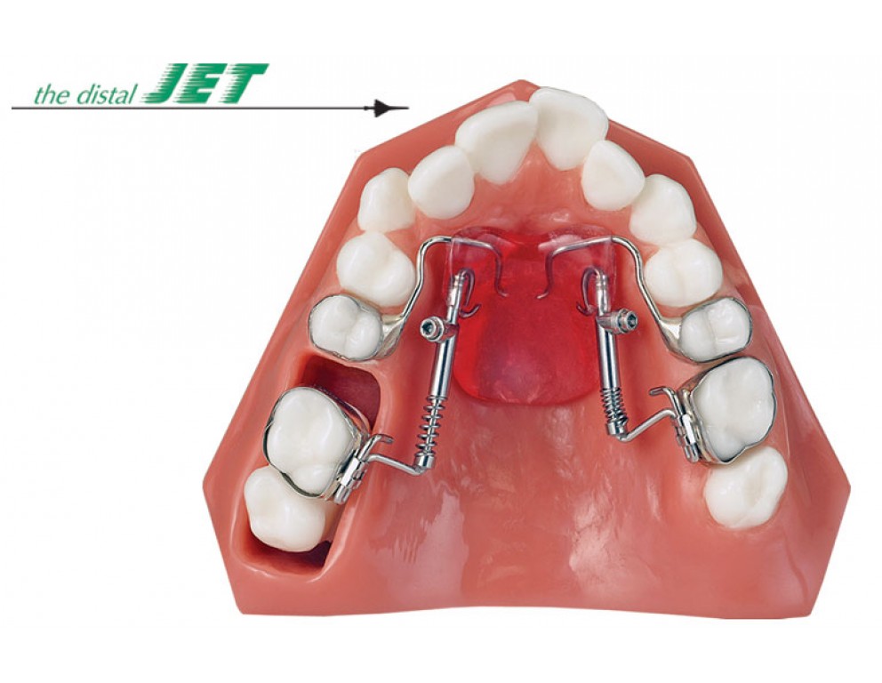Jet Family American Orthodontics