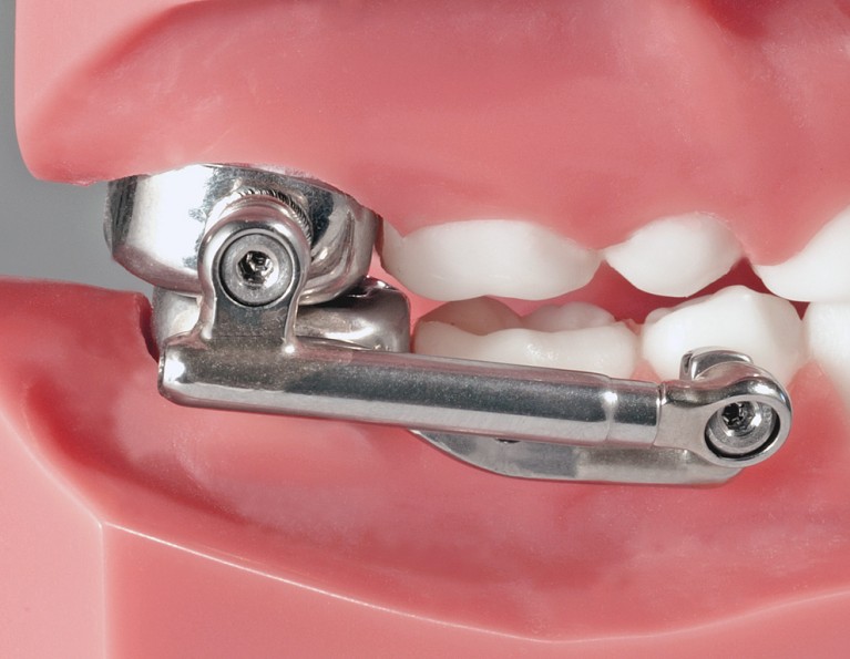 Fixed & Functional American Orthodontics